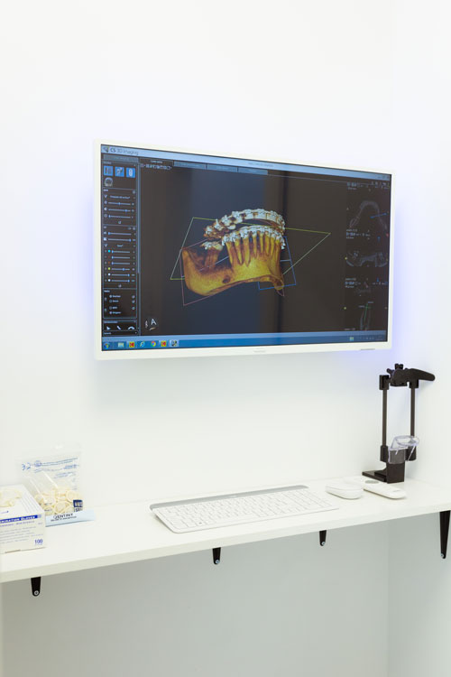 Pantalla diagnostico